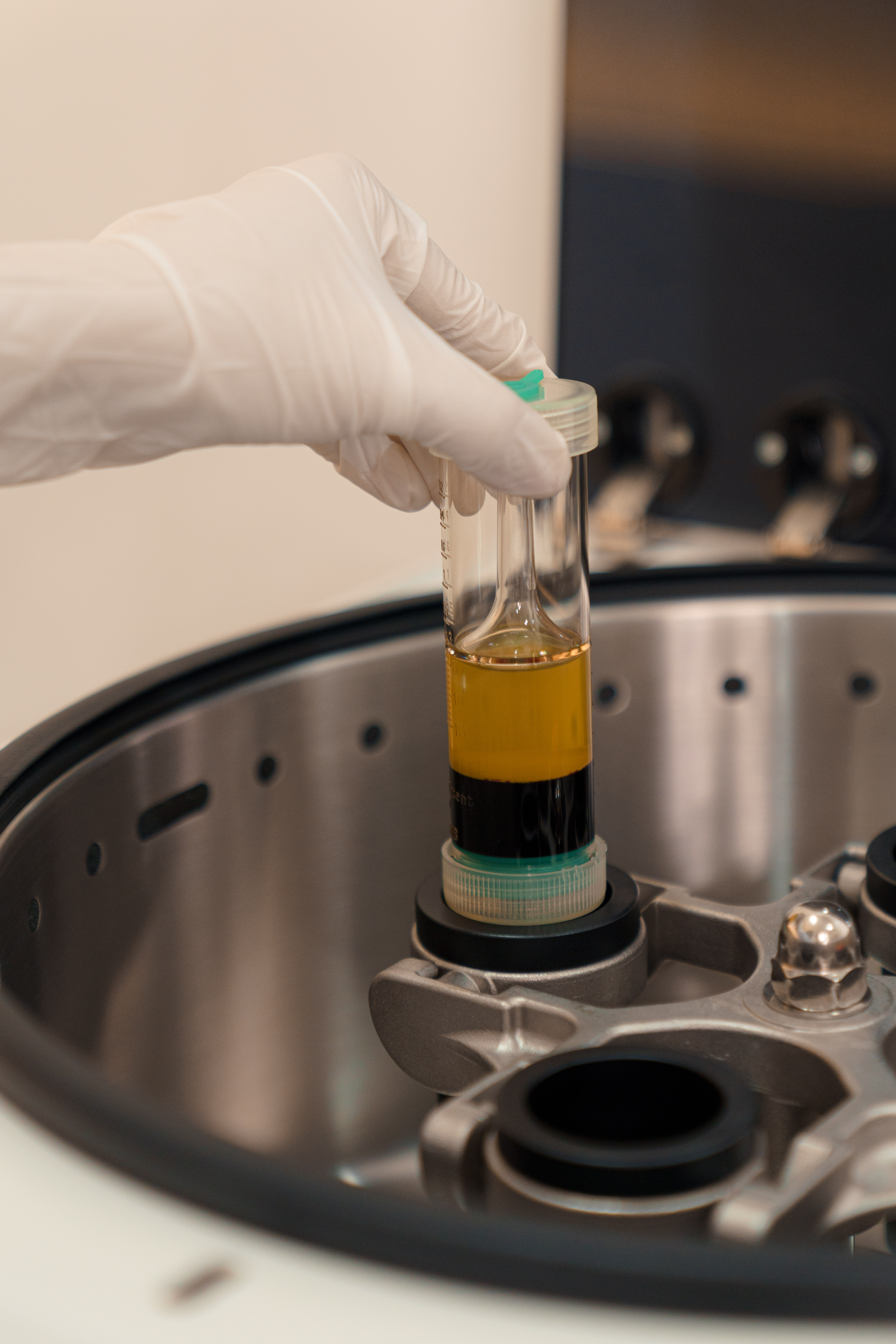 PRP – Platelet-Rich Plasma